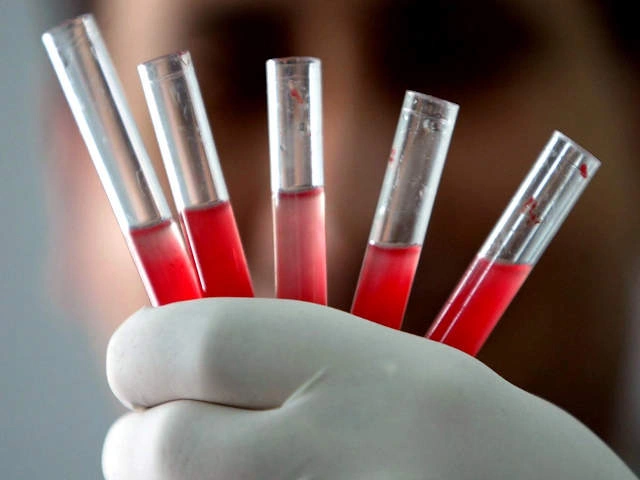 Что такое "золотая кровь" или самая редкая группа крови в мире
