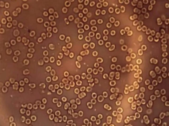 Снимки крови после вакцин под микроскопом