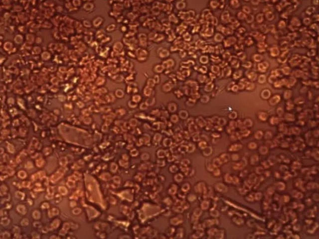 Снимки крови после вакцин под микроскопом